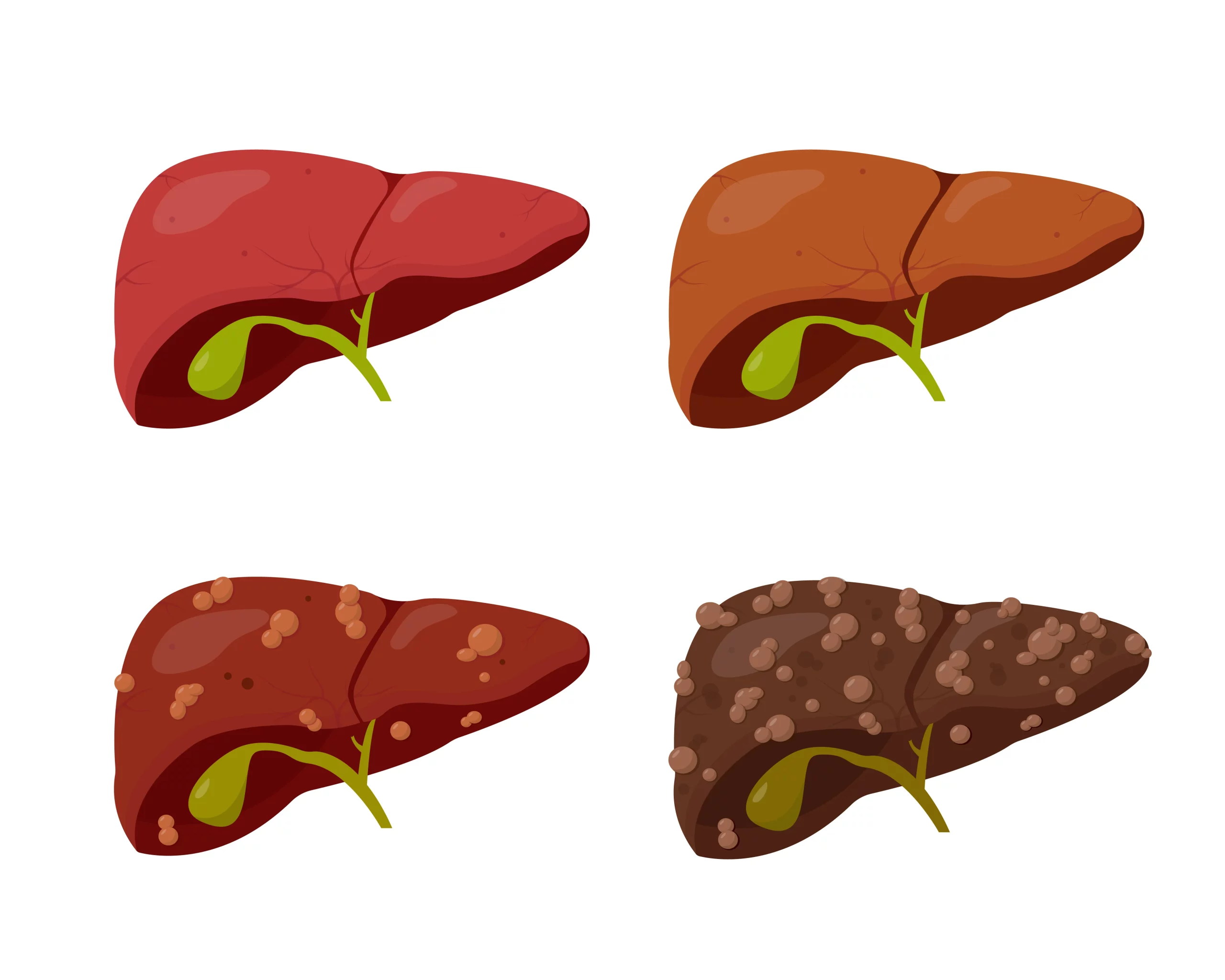 Abnormal liver enzymes