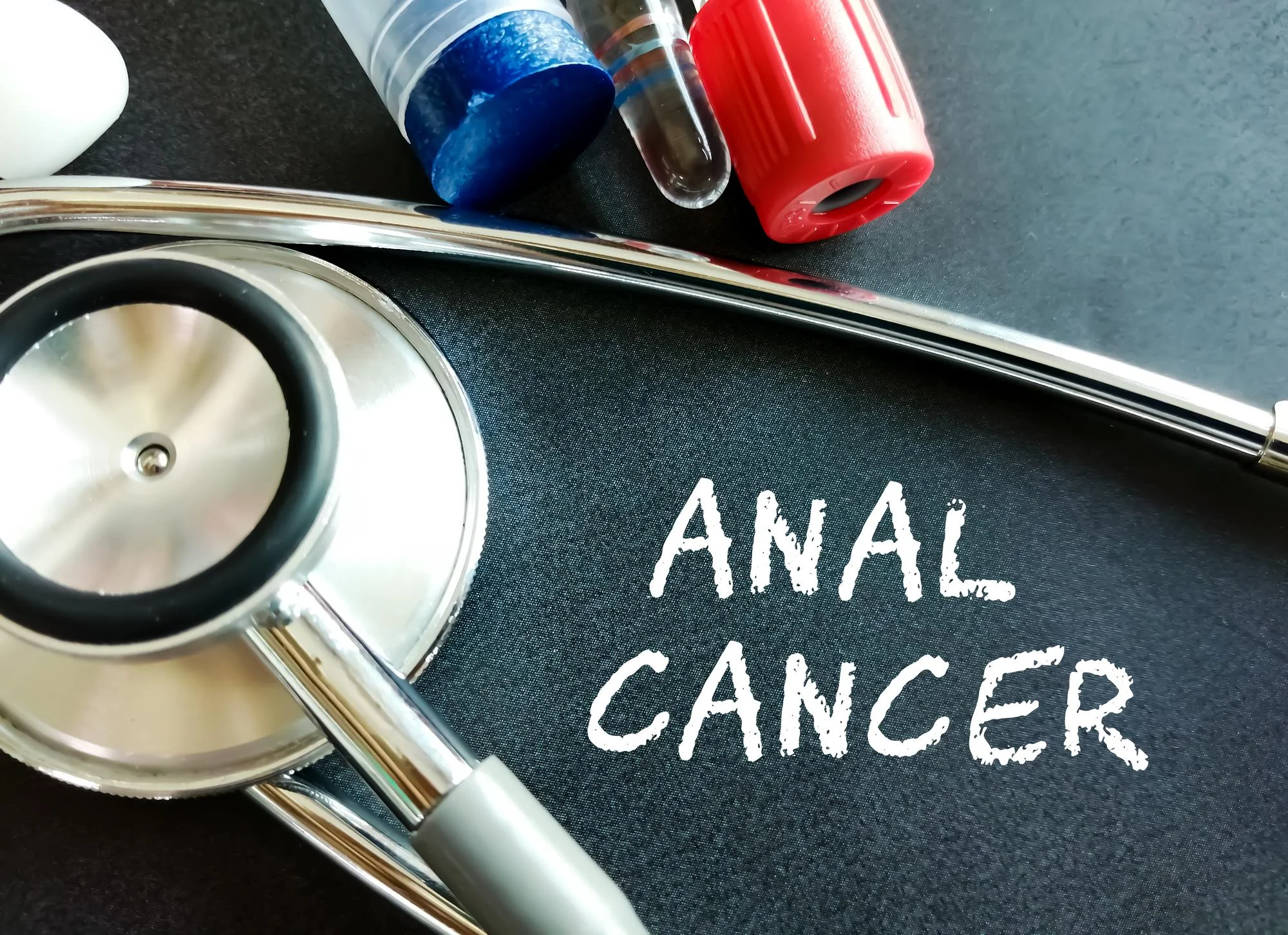 Anal cancer