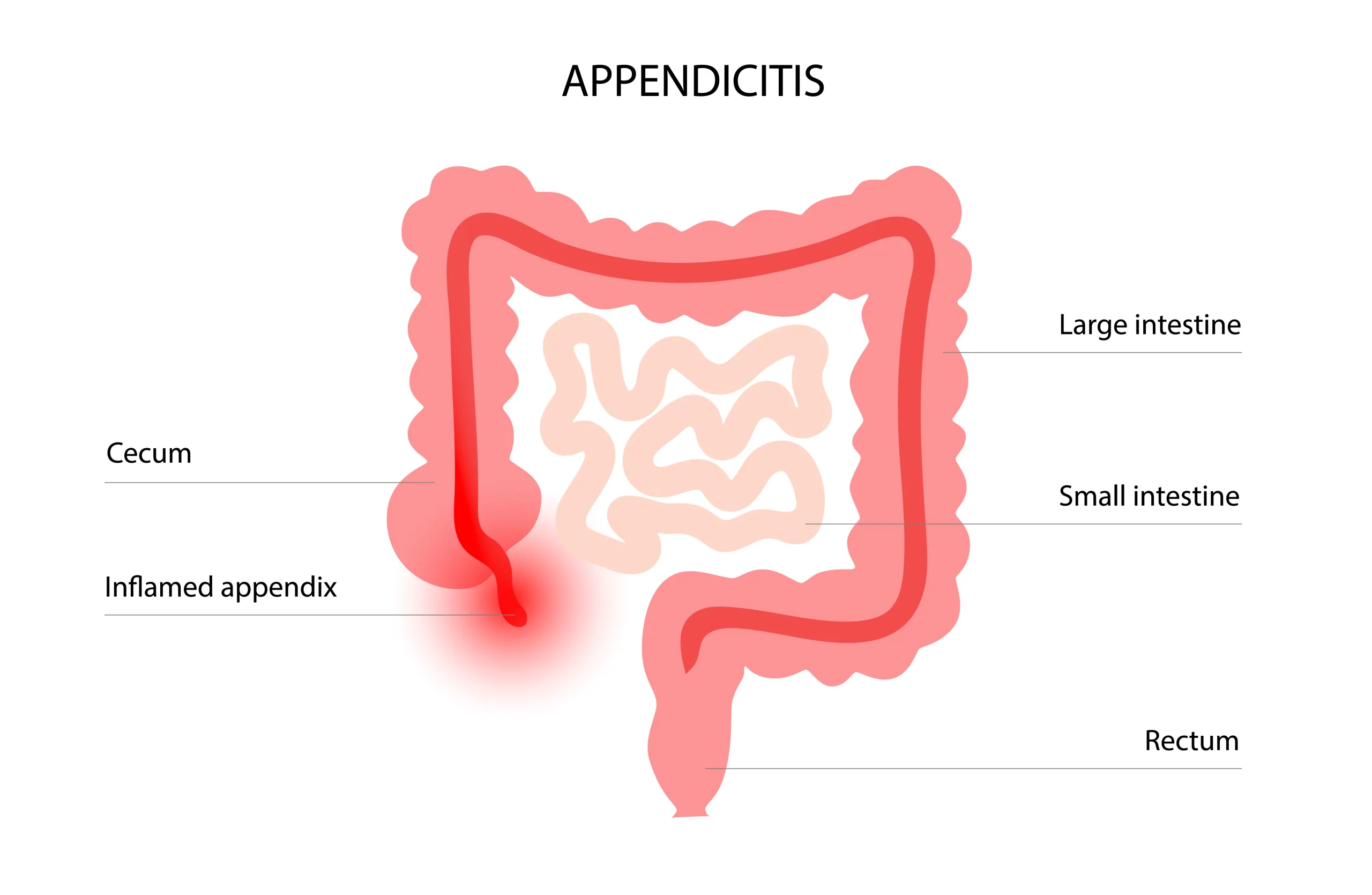 Appendix
