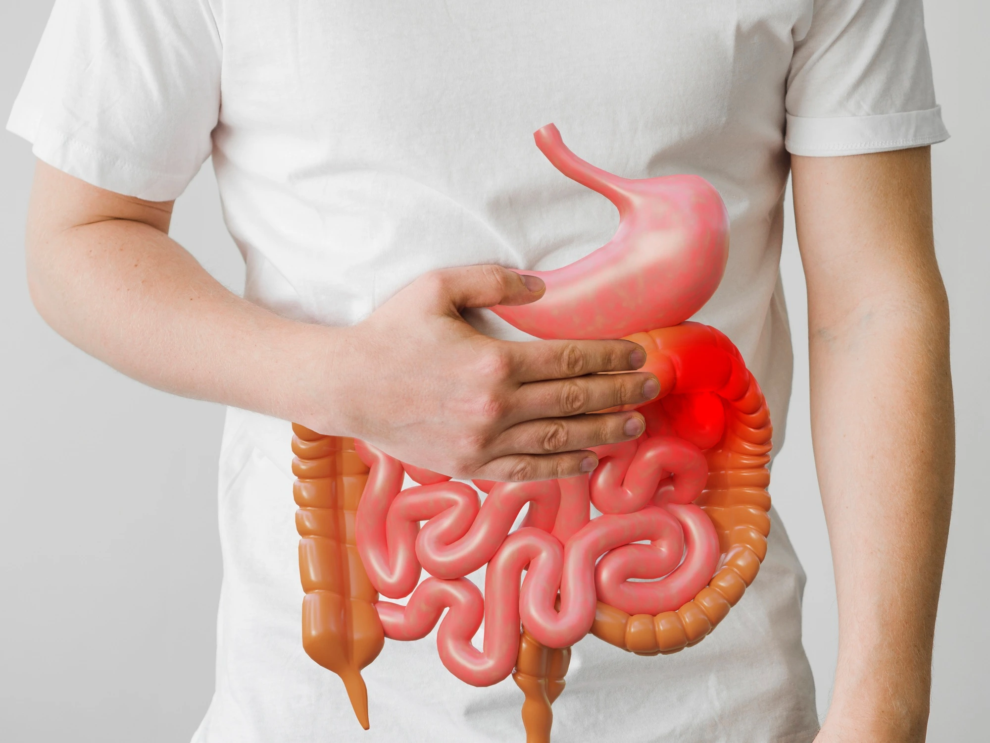 Crohn's Disease