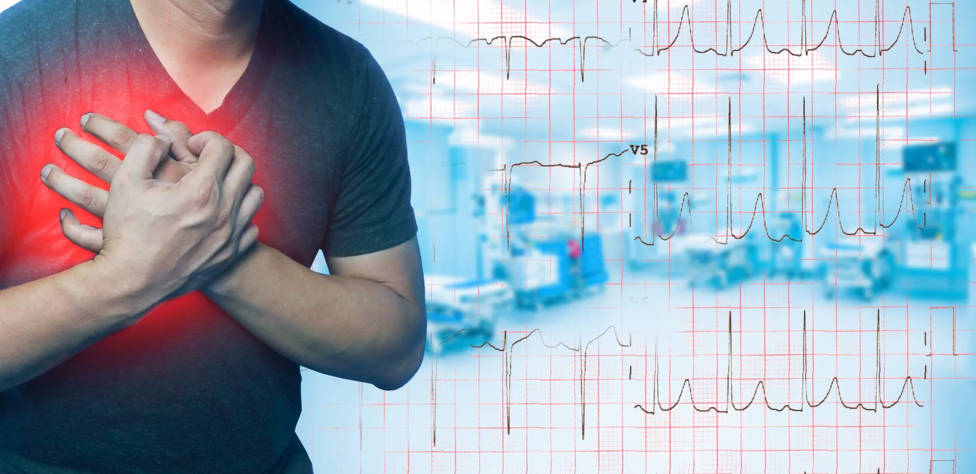 Supraventricular tachycardia