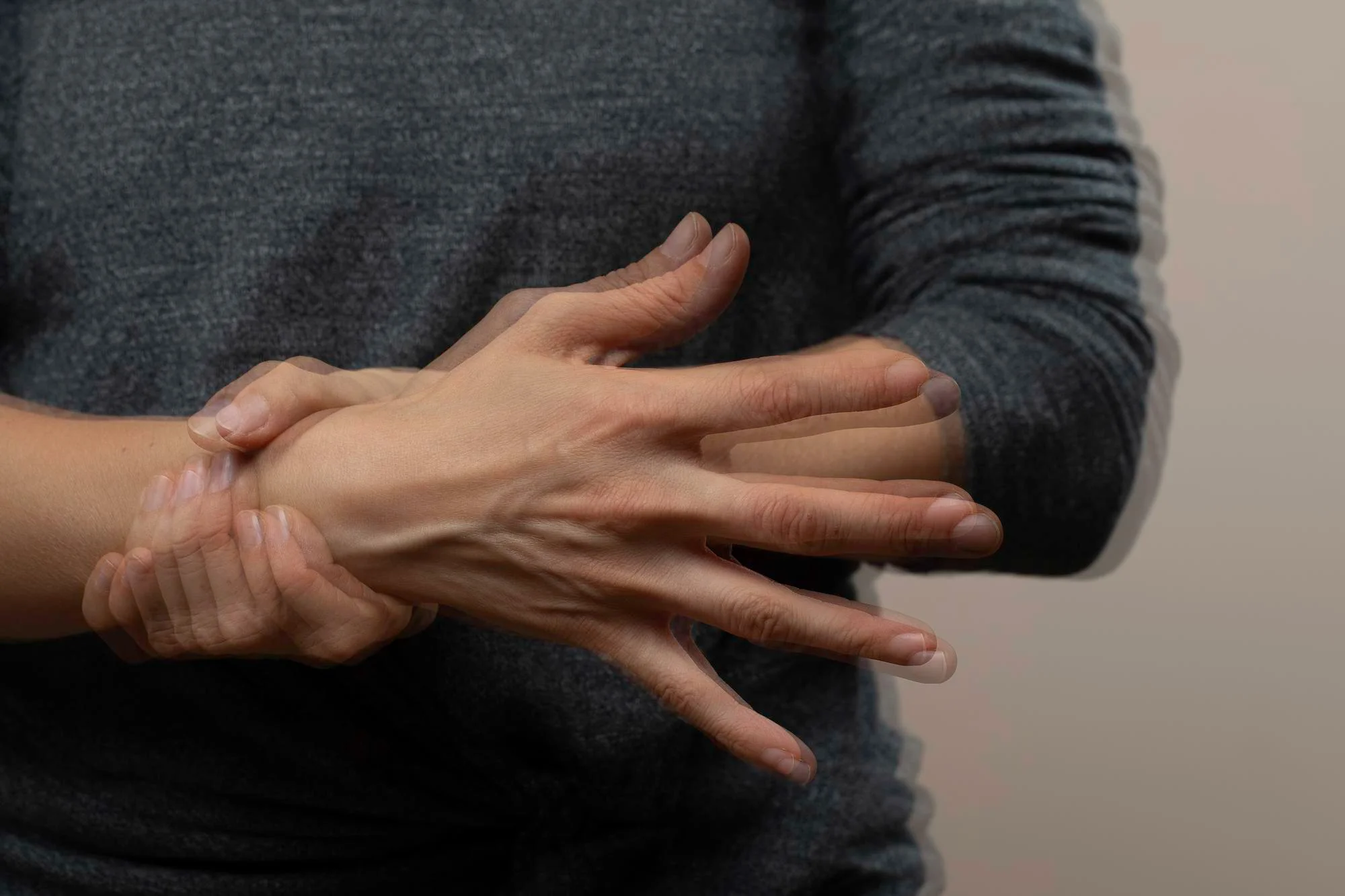 Transient Ischaemic Attack