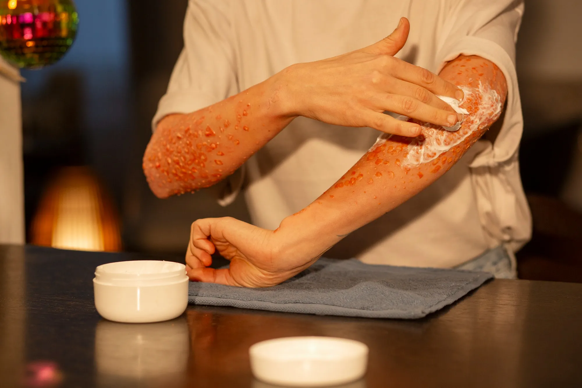 Inflammation treatment