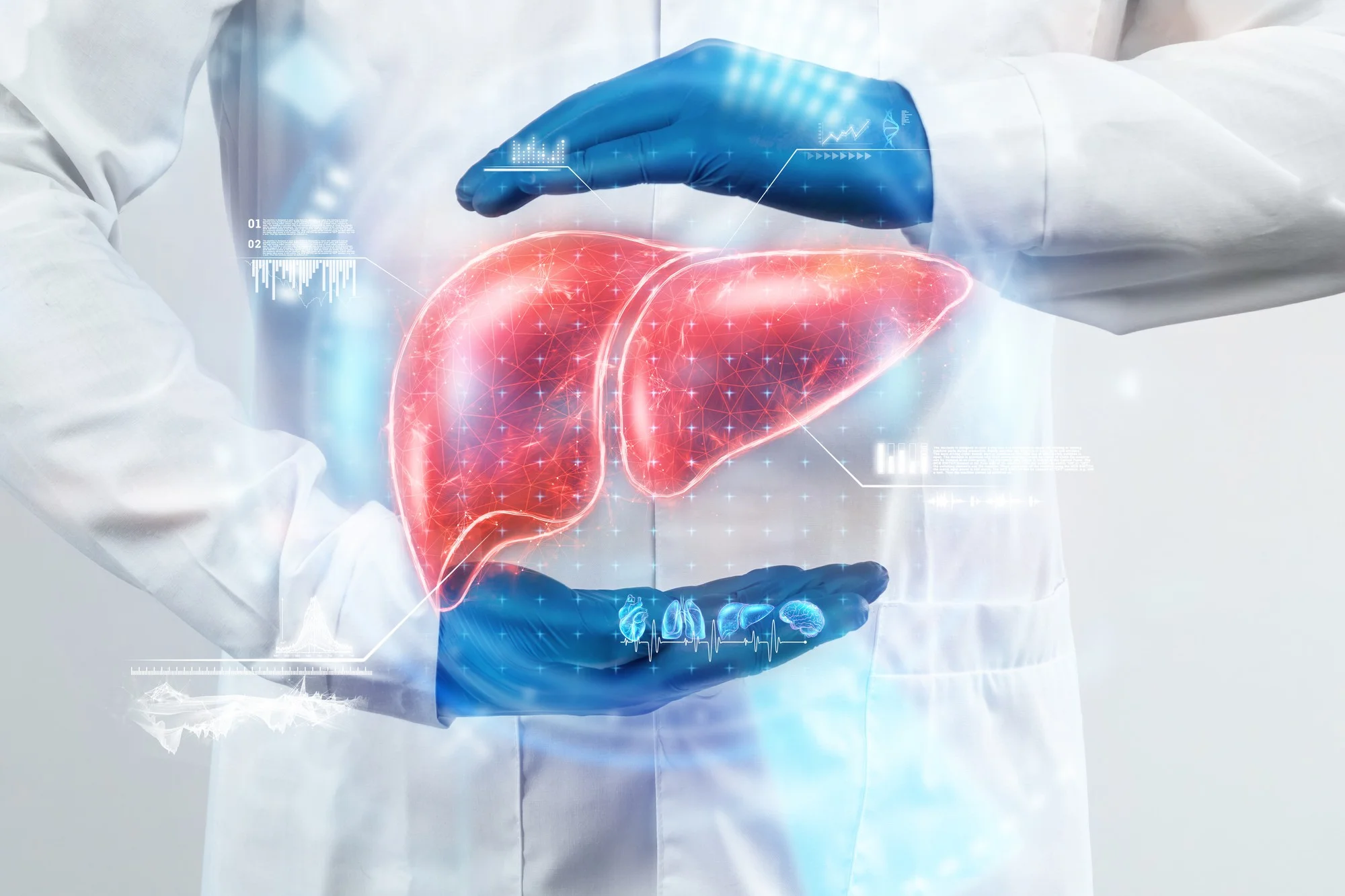 Liver transplantation