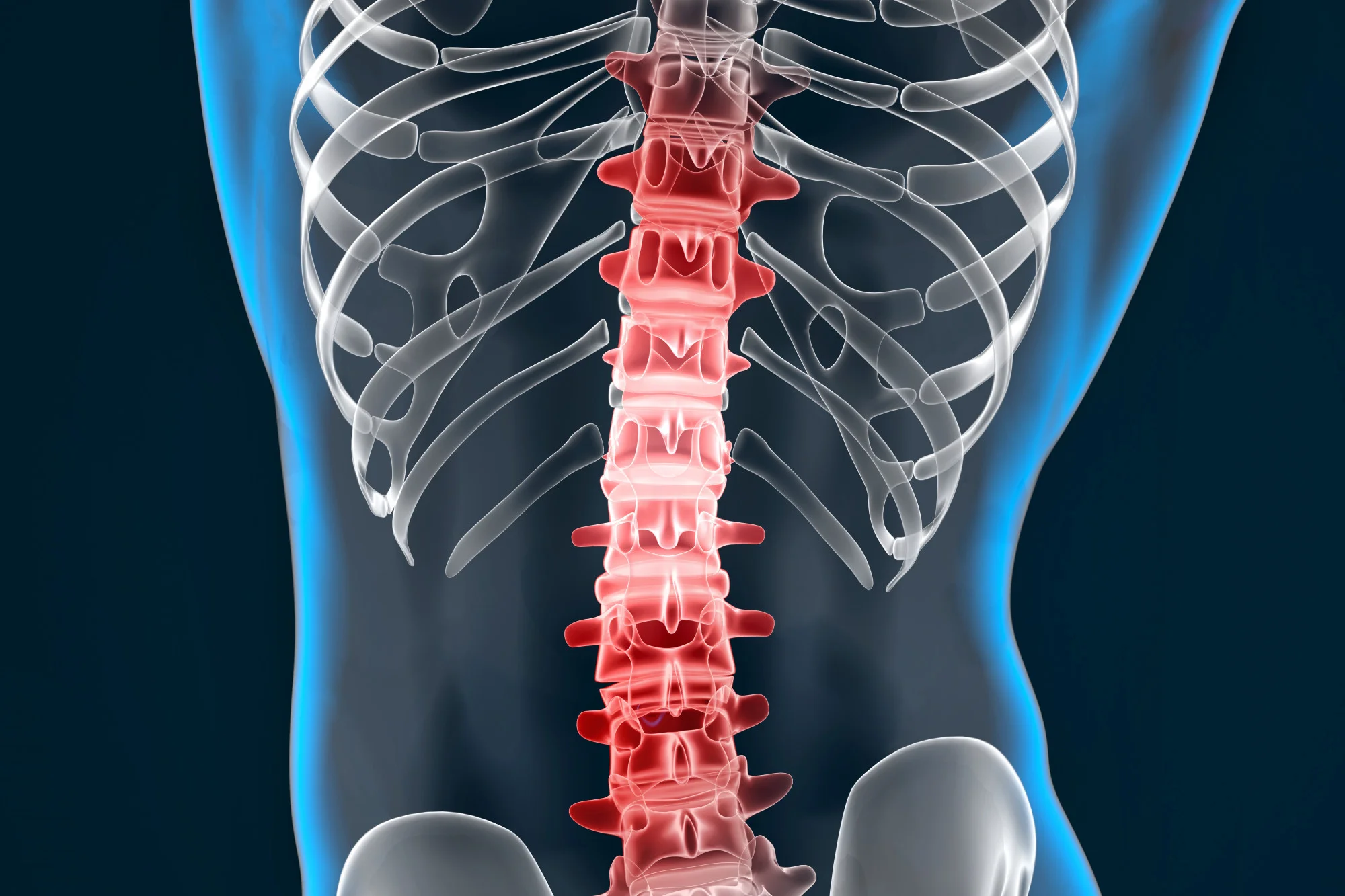 Spinal tumors