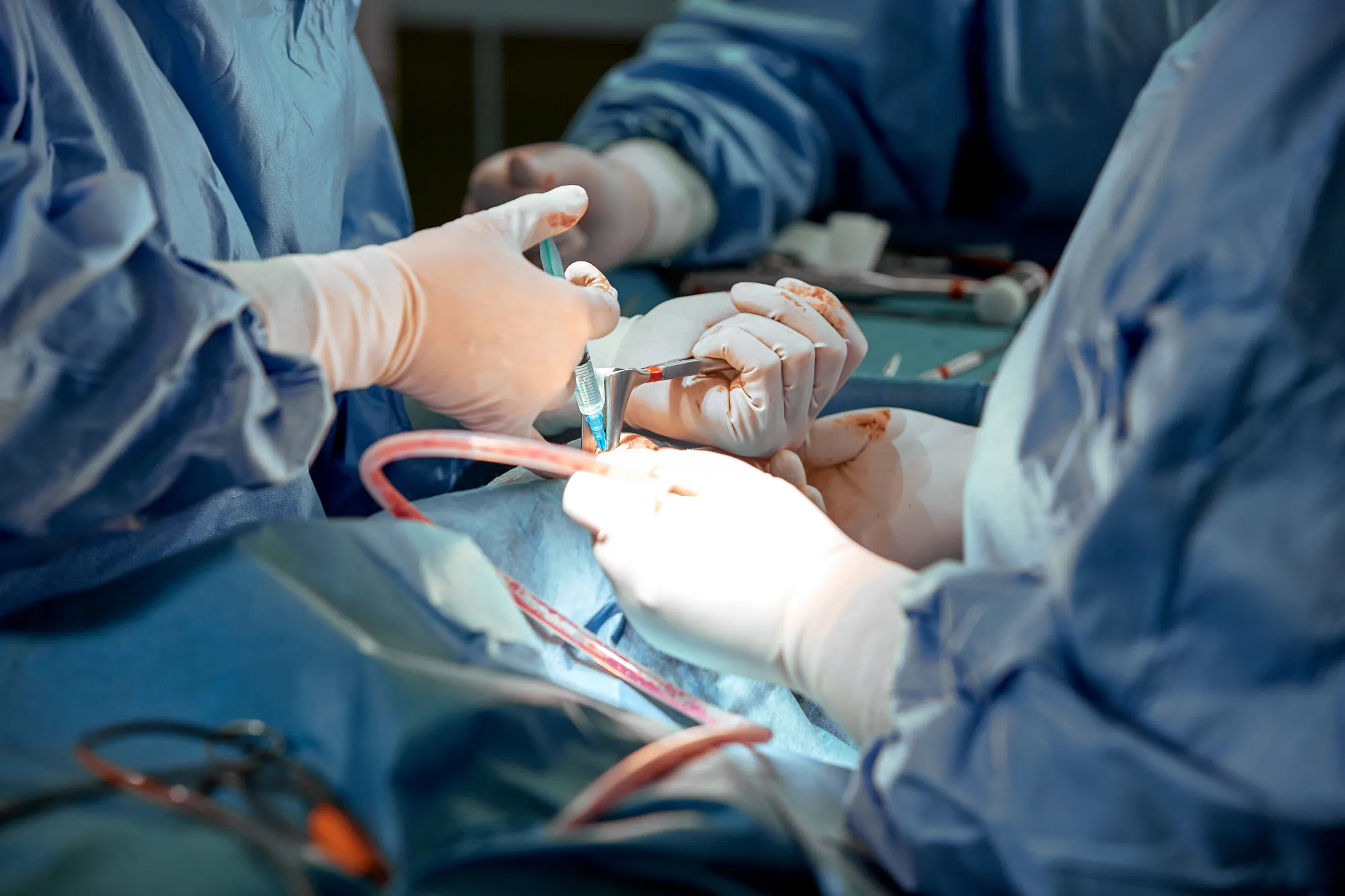 Cardiac surgery