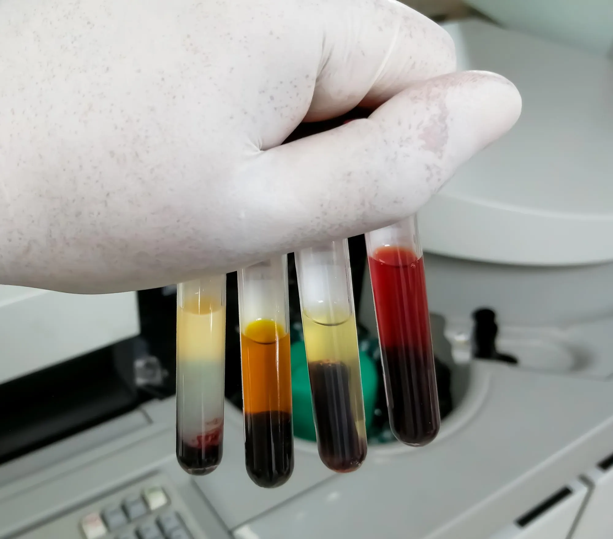 Chromatography