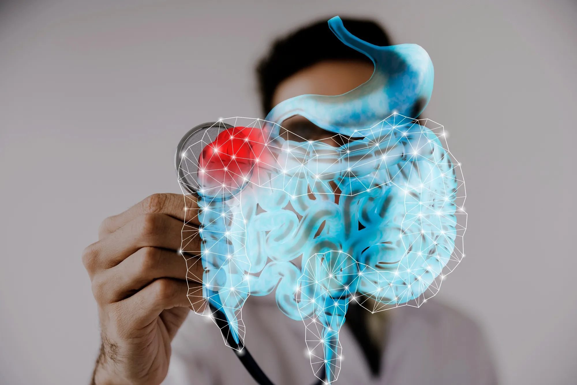 Colorectal cancer