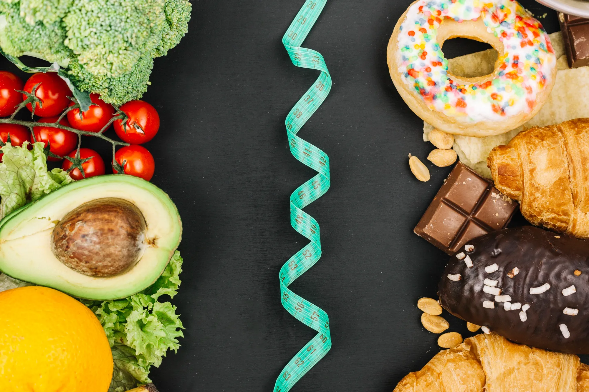 Diet Restrictions