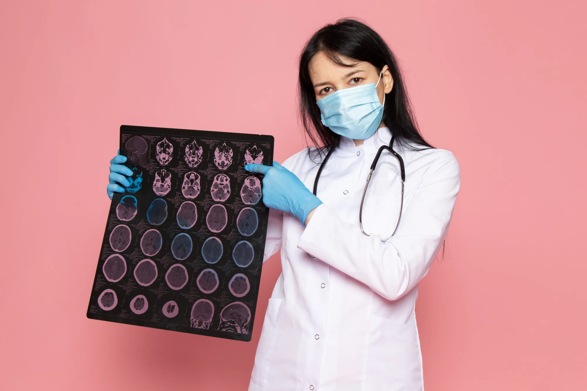 Female neurologists