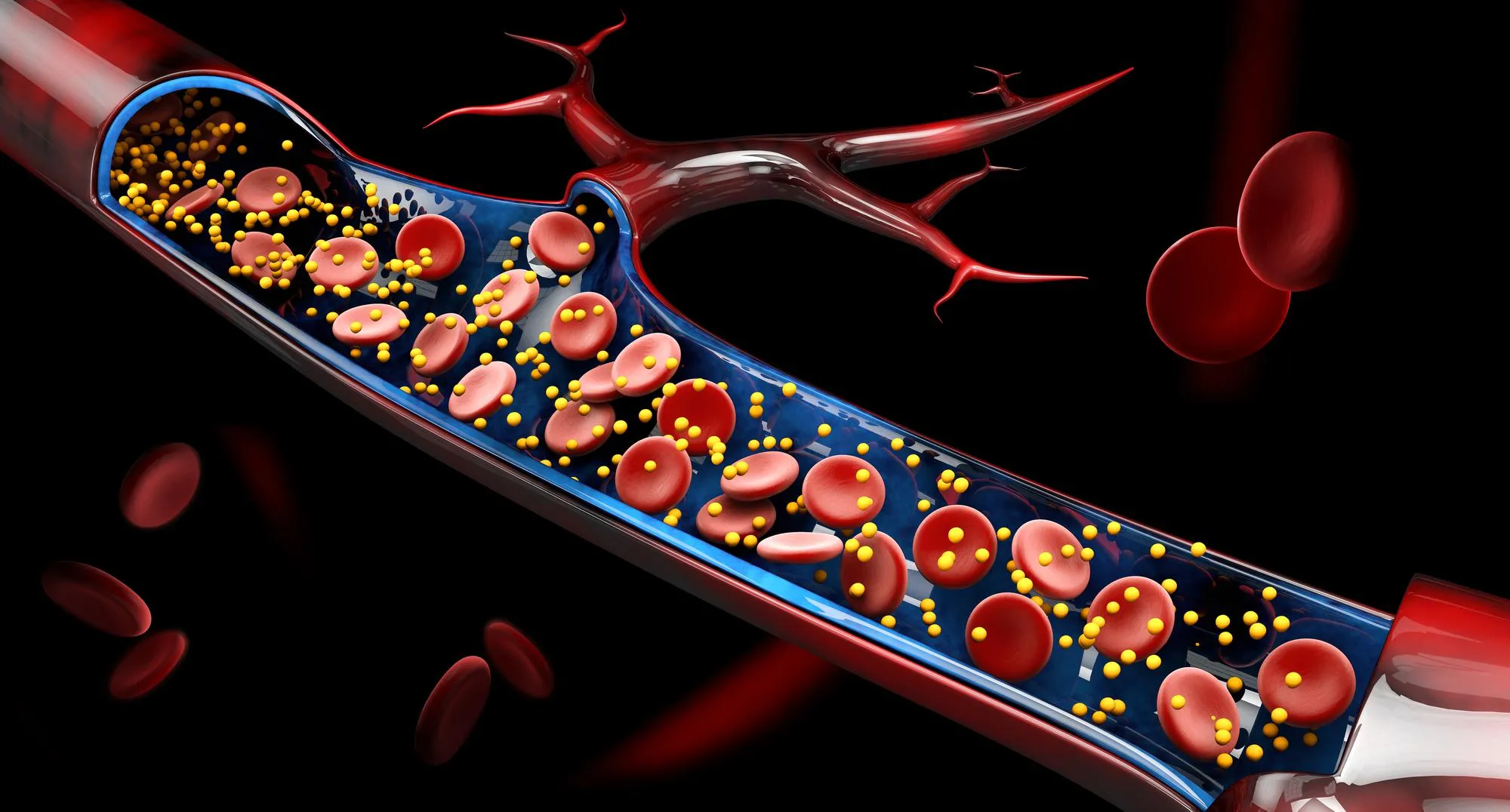 Giant cell arteritis