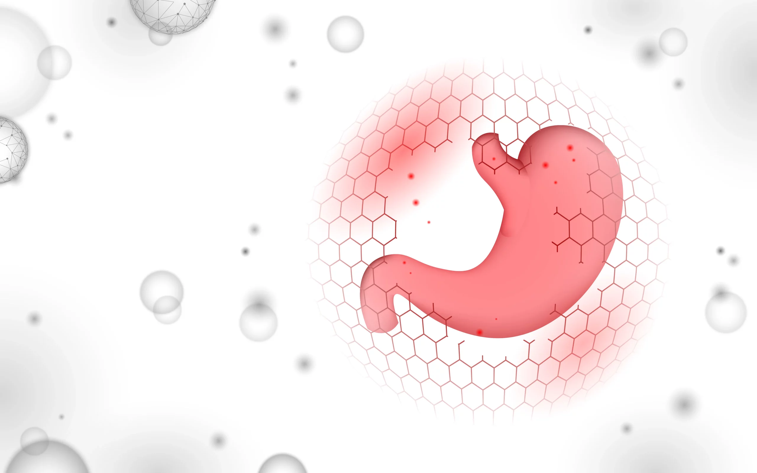 Gastric cancer
