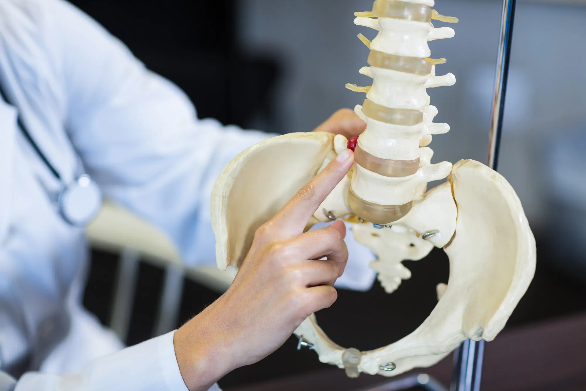 Hip fracture
