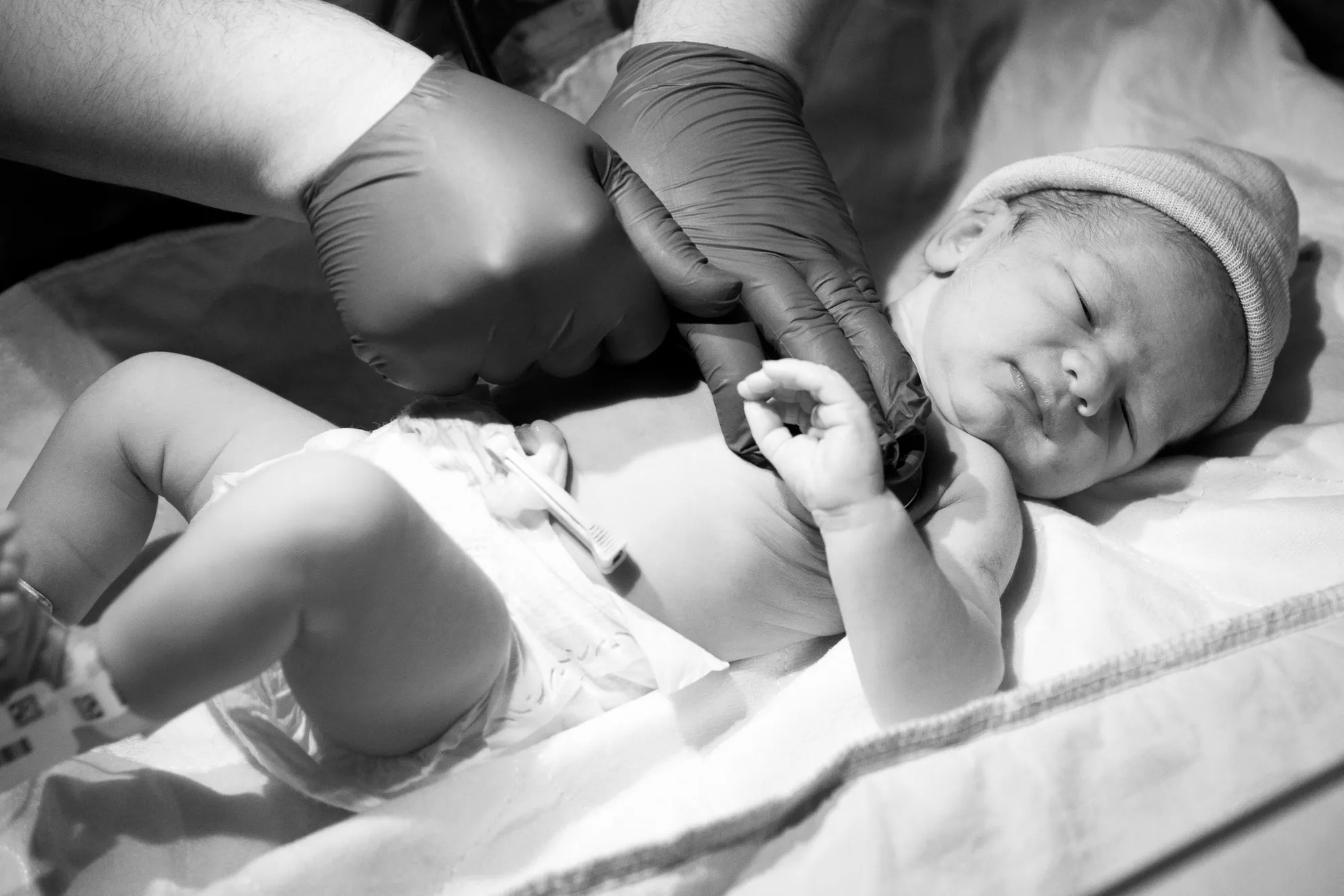Infant cardiac surgery