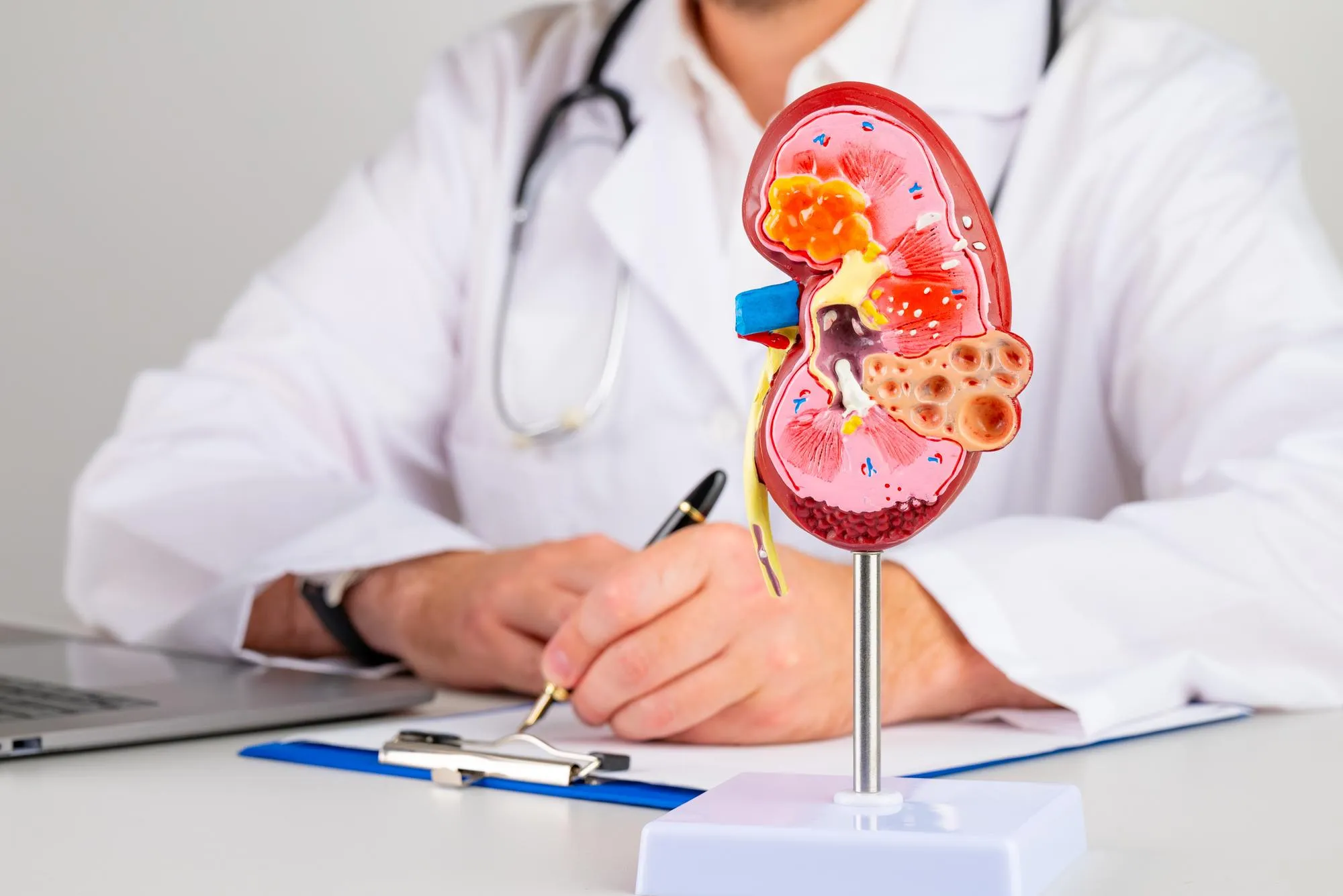 Kidney disease