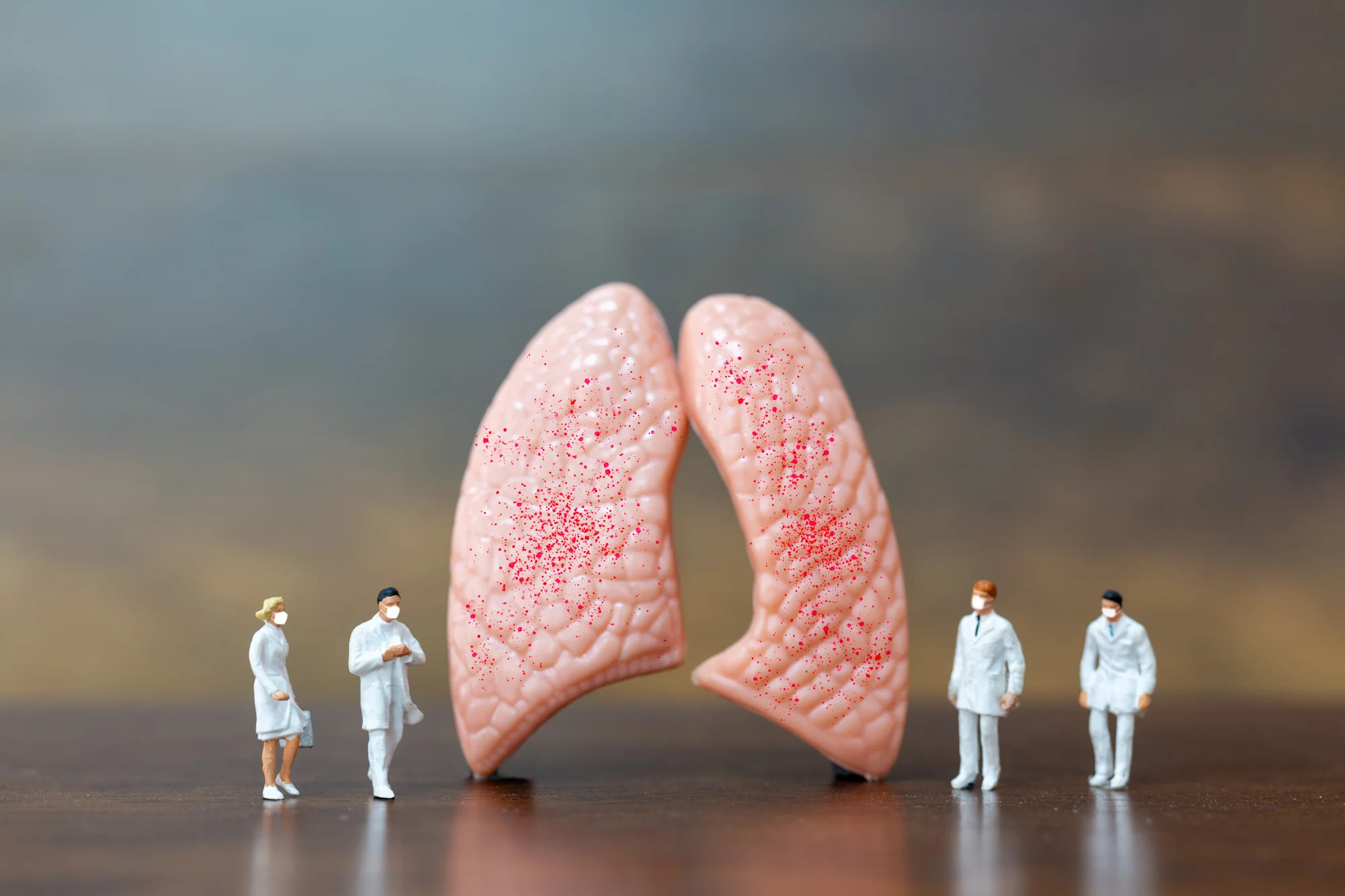 Lung cancer inhibitor