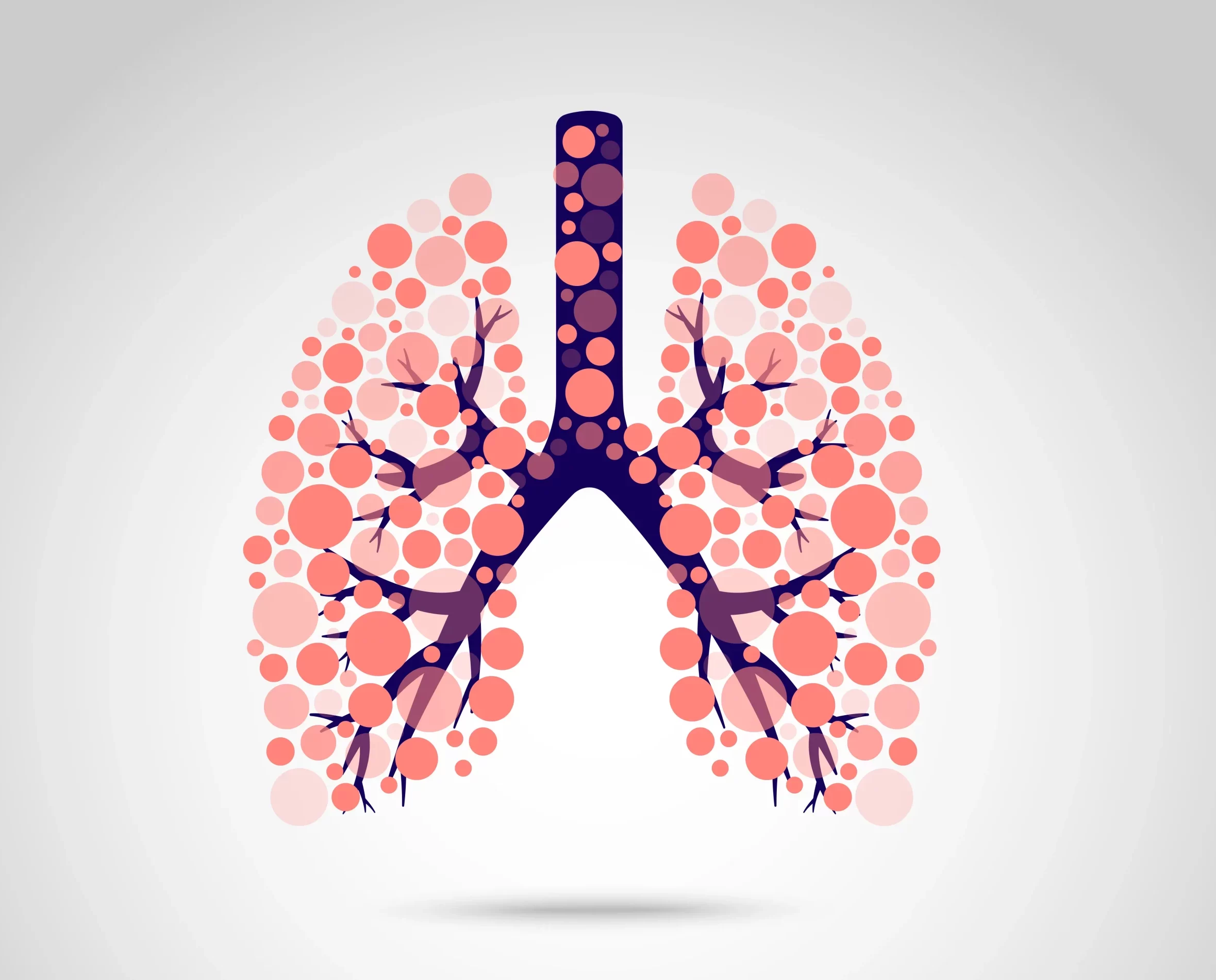 Lung cancer