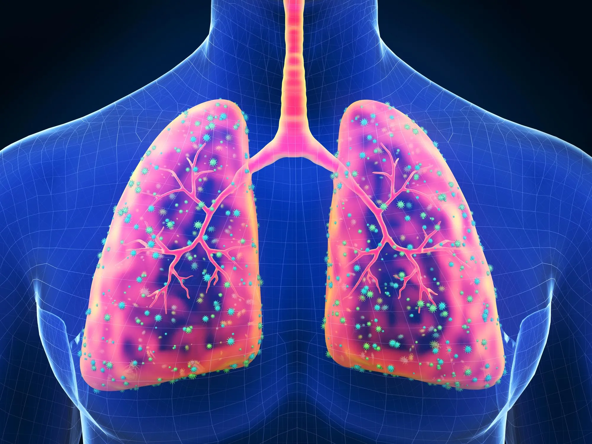 Lung diseases