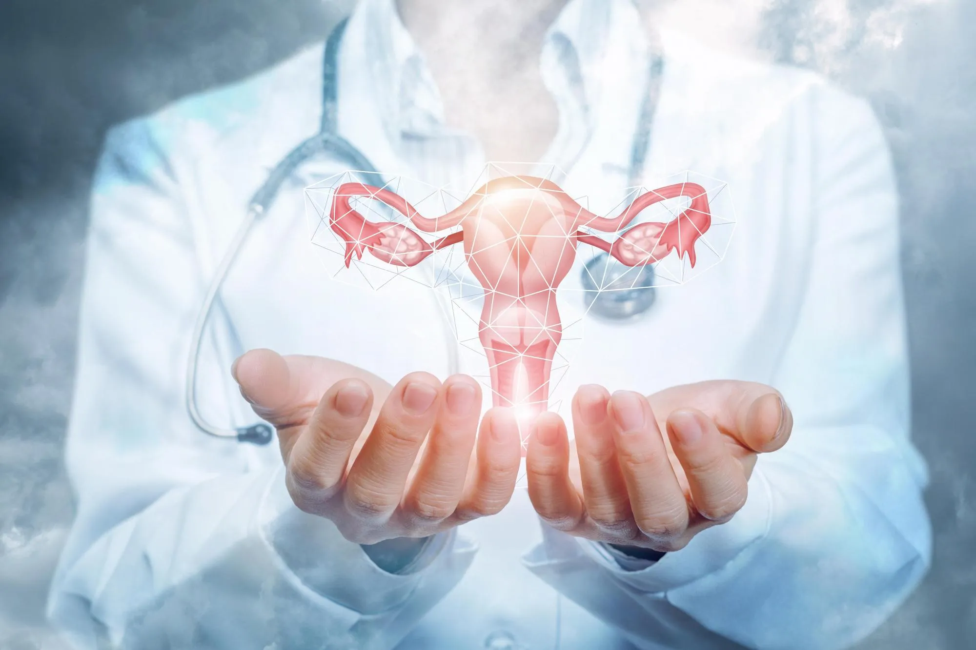 Ovarian cancer