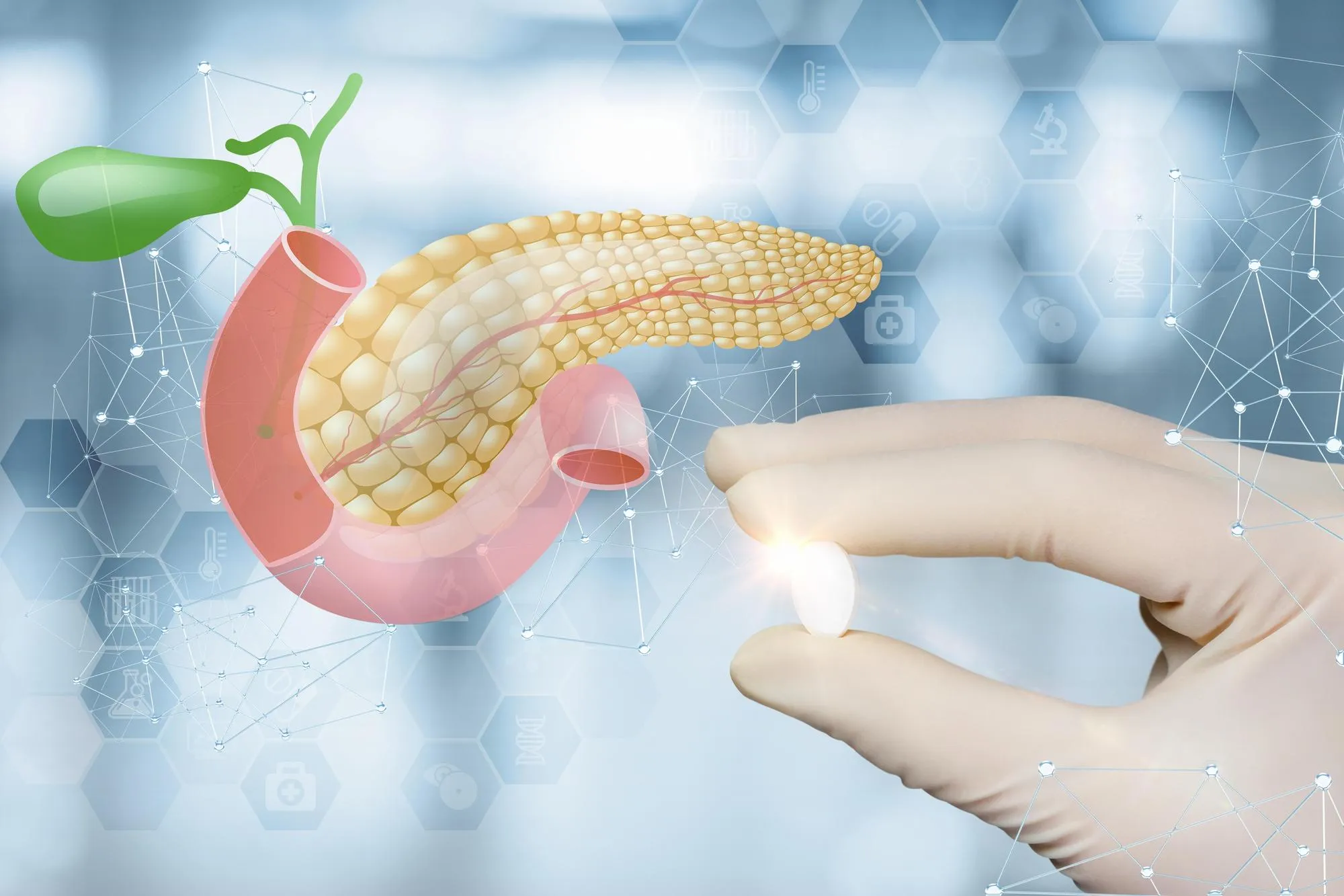 Pancreatic cancer