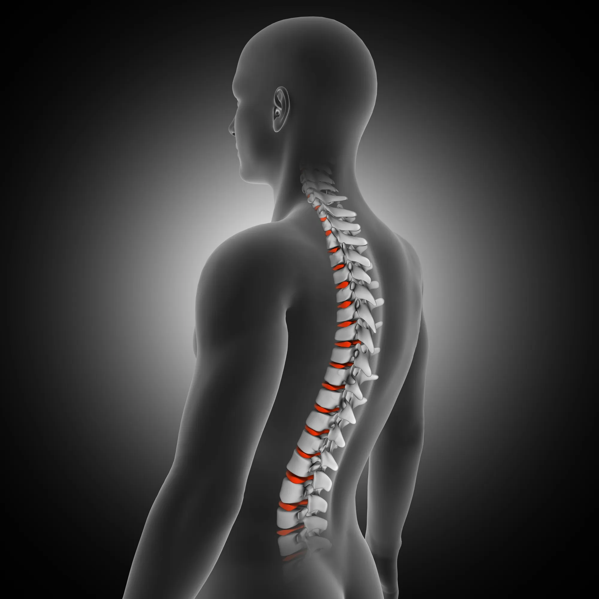 Spinal cord compression