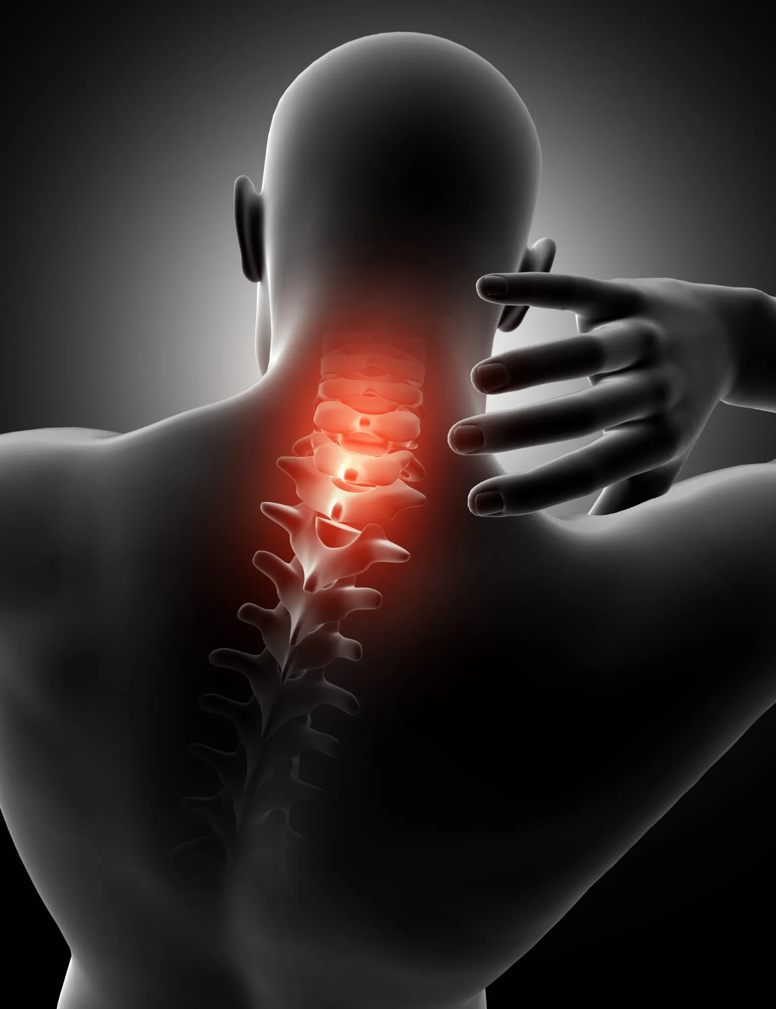 Spondylitis