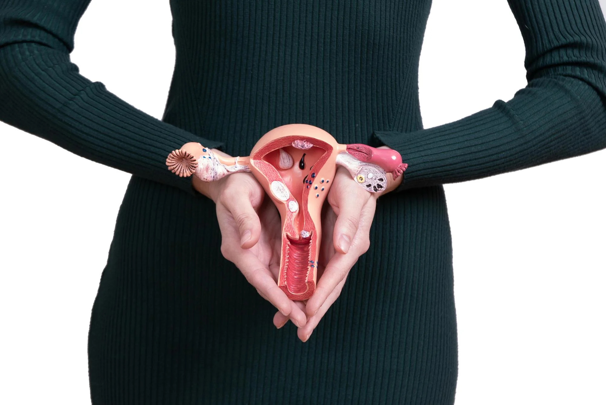 Uterine Fibroid