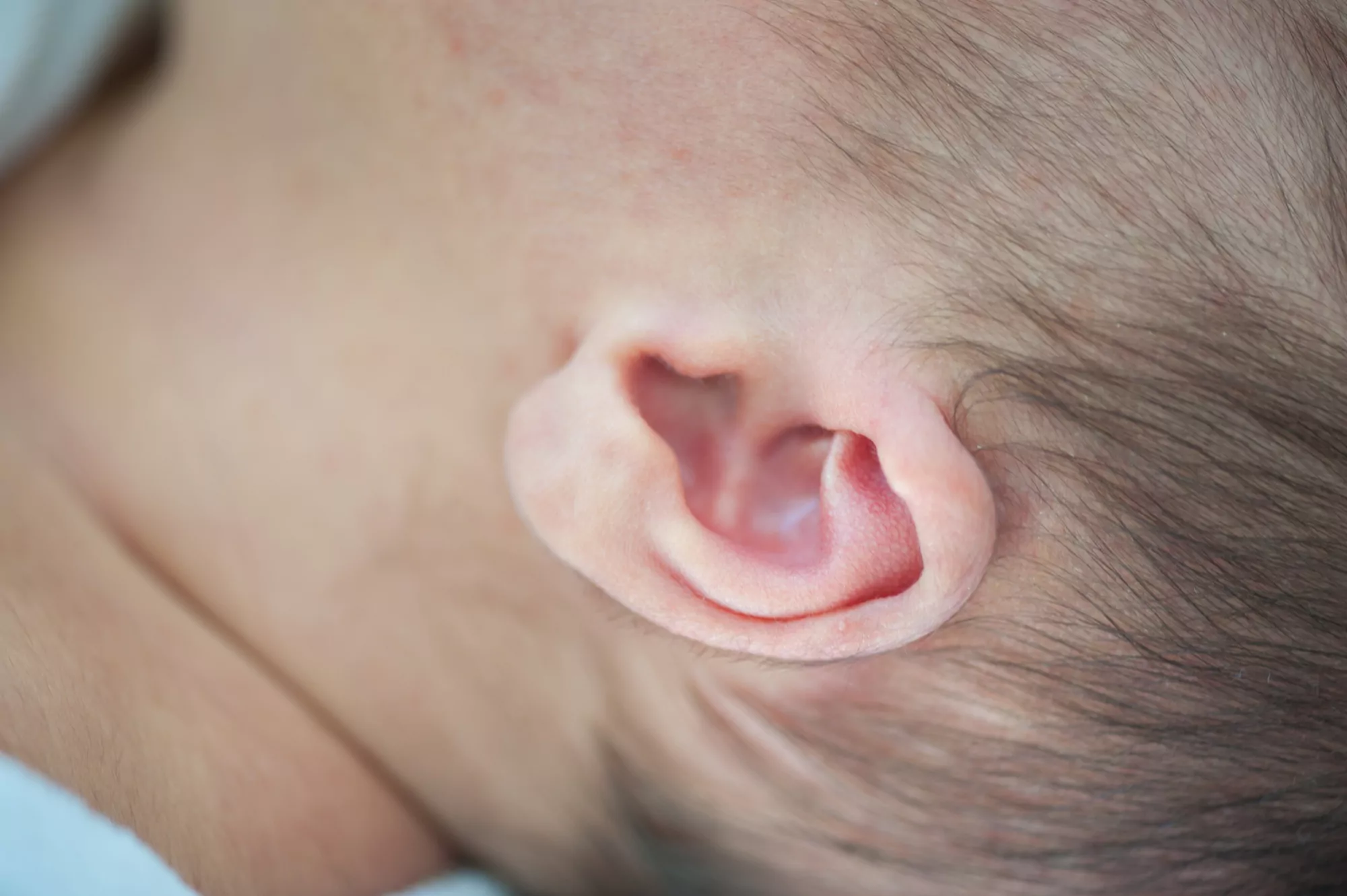 Neonatal hearing